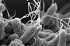 E-coli_(Escherichia_coli)