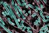H5N1_Avian_Influenza_A_Virus