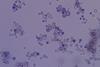 Cryptococcus_in_India_Ink