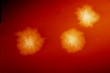 Clostridium_difficile_colonies