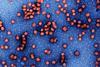 Hepatitis_b (1)