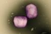 Mpox_Virus_-_53858992909