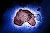 Human_Respiratory_Syncytial_Virus_(RSV)_-_2111