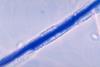 Aspergillus_flavus_01