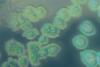 Pseudomonas_aeruginosa_on_cetrimide_agar
