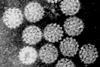 Papilloma_Virus_(HPV)_EM_(new_version)