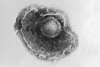 zoster