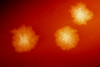 Clostridium_difficile_colonies