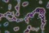 Candida_albicans_(251_12)