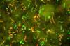 Lyme_Disease_Bacteria,_Borrelia_burgdorferi_(5661846104)