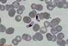 P.falciparum-gametocytes