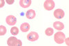 Blood_smear_of_Babesia_microti,_original (1)