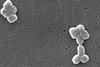 Acinetobacter_baumannii,_SEM,_9330_lores