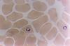 Plasmodium_falciparum_in_Red_Blood_Cells