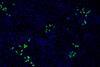 Low-Res_Virologie-HEV