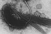 960px-Vibrio_cholerae