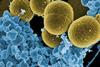 576px-Staphylococcus_aureus_bacteria_escape