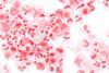 Neisseria_meningitidis_CSF_Gram_1000