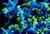 Lassa_Virus_-_51719109817