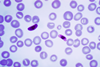 Plasmodium_falciparum_01