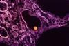 West_Nile_Virus_Particle