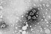 Hepatitis_B_virus_01