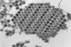 960px-Chikungunya_virus_particles-PHIL-17369