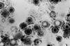 Herpes_simplex_virus_TEM_B82-0474_lores