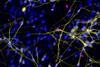 Low-Res_Image 1 - Neurons + ZIKV-LAV