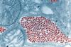Eastern_equine_encephalitis