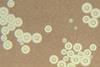 Cryptococcus_neoformans_using_a_light_India_ink_staining_preparation_PHIL_3771_lores