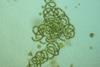960px-Dolichospermum_crassum