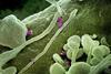 Crimean-Congo_Hemorrhagic_Fever_(CCHF)_Virus_-_3