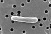 Escherichia_coli_(SEM)