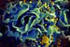 HIV-infected_T_cell_(6813489183)