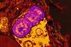 Klebsiella_pneumoniae_bacteria_with_a_human_neutrophil_(red)_containing_ingested_Klebsiella_pneumoniae_(purple)