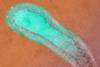 Human_Respiratory_Syncytial_Virus_(RSV)_(52453014952)
