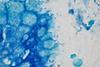 Helicobacter_pylori,_Gastric_Mucosa,_Giemsa_stain