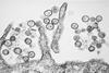 Sin_Nombre_hanta_virus_TEM_PHIL_1136_lores