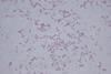 Klebsiella_oxytoca