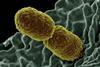 Klebsiella_pneumoniae_Bacterium_(13383411493)