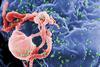 960px-HIV-budding-Color