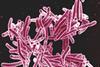 Mycobacterium_tuberculosis_Bacteria,_the_Cause_of_TB_(5149398656)