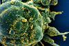 SARS-COV-2_virus (2)