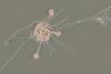 Bdelloid rotifer Infected and killed by fungal infection Credit Chris G Wilson_1