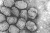 Smallpox_virus