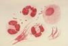 Neisseria_gonorrhoeae_PHIL_3693_lores