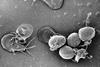 Giardia_lamblia_culture