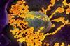 SARS-CoV-2_scanning_electron_microscope_image