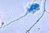 Aspergillus_fumigatus_01